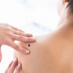 Diabetes Type 2 Symptoms Signs and symptoms Signs and signs and symptoms