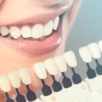 What are the causes and cures of a gummy smile?