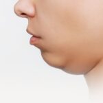 The Definitive Guide to Healing a Torn Labrum in the Hip