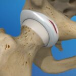 Overview of Common Contraceptive Methods in the UK: A Clinical Perspective for Healthcare Practitioners