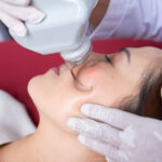 The Process of Getting Porcelain Veneers