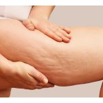 Smooth Skin Secrets: Your Guide to Laser Hair Removal in Summerlin