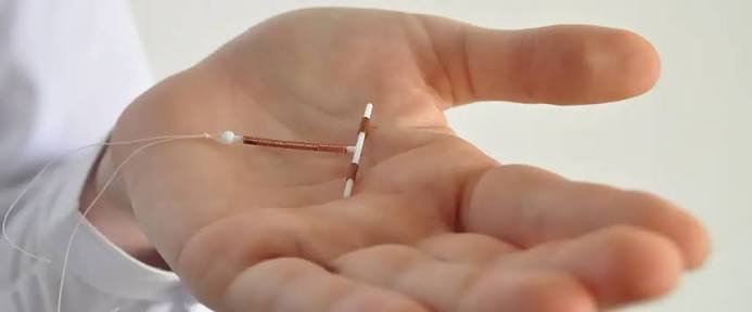 IUD Replacement